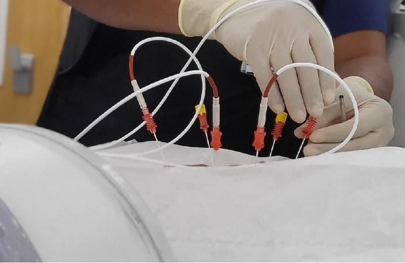 Interventional Pain Procedures